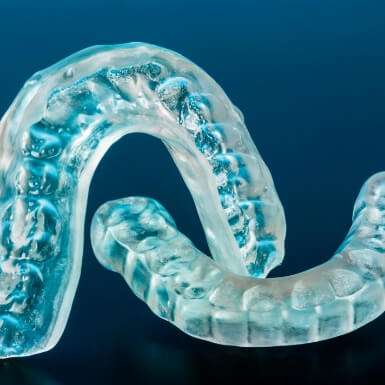 Custom occlusal splints