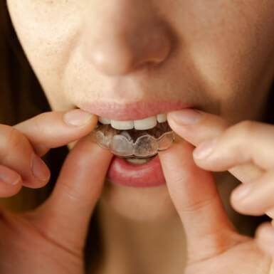 Person placing oral appliance for equilibration and occlusal adjustment